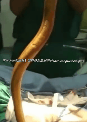 图片[5]-【特殊资源】当年火遍全网的黄鳝门事件，相信大家都看过了-51欢迎您！